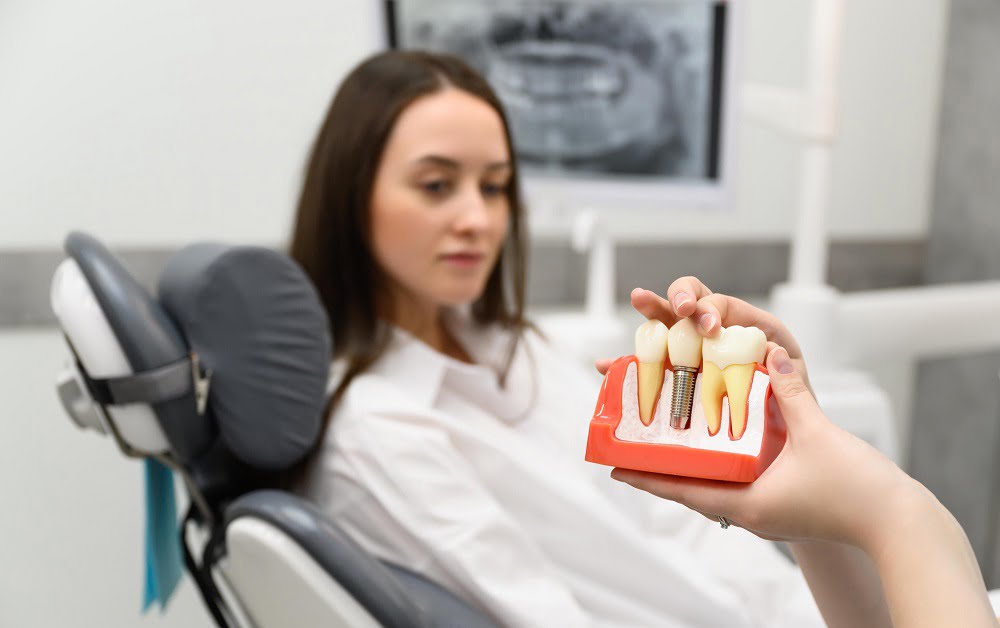 A dental professional holds a model of a dental implant to show a seated patient, who watches attentively while seated in a dental chair - dental implants A dental professional holds a model of a dental implant to show a seated patient, who watches attentively while seated in a dental chair - dental implants
