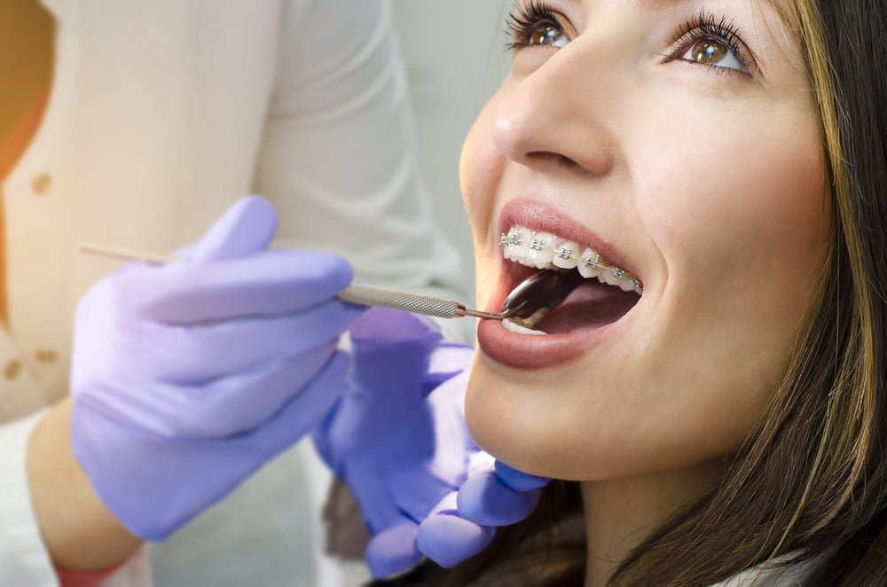 A woman with braces smiles while a dentist in gloves uses a dental instrument to check her teeth - teeth braces A woman with braces smiles while a dentist in gloves uses a dental instrument to check her teeth - teeth braces