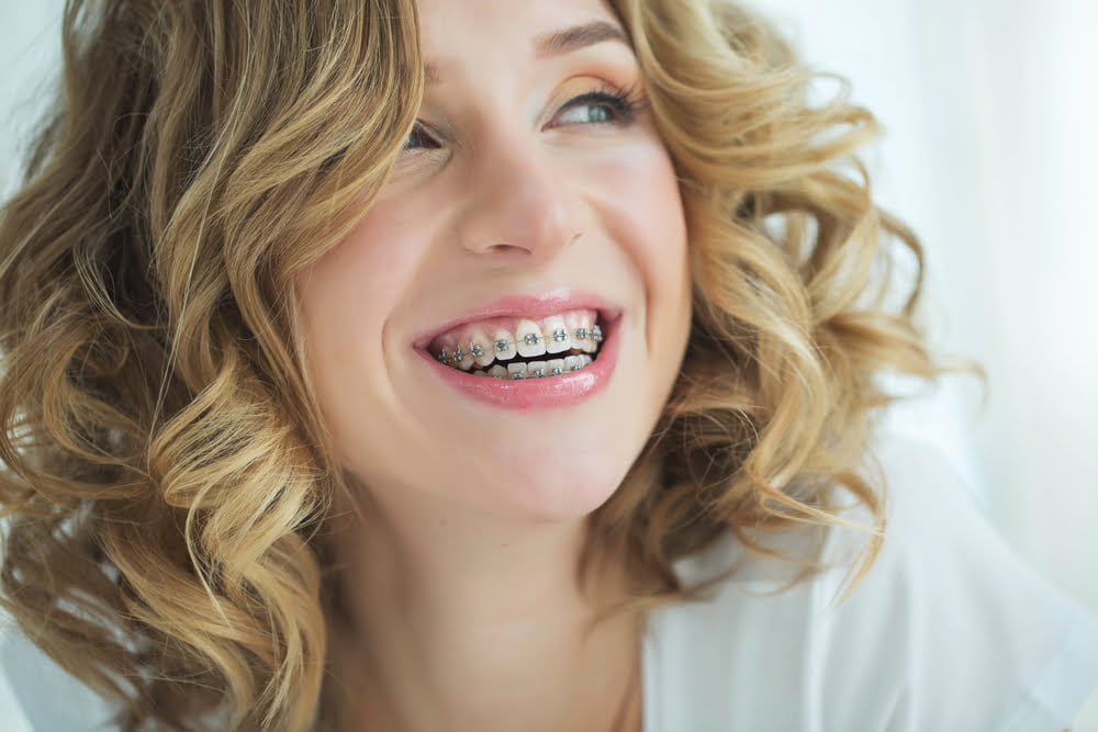 A woman with blonde curly hair smiles while showing her braces, revealing metal brackets on her teeth - teeth braces A woman with blonde curly hair smiles while showing her braces, revealing metal brackets on her teeth - teeth braces